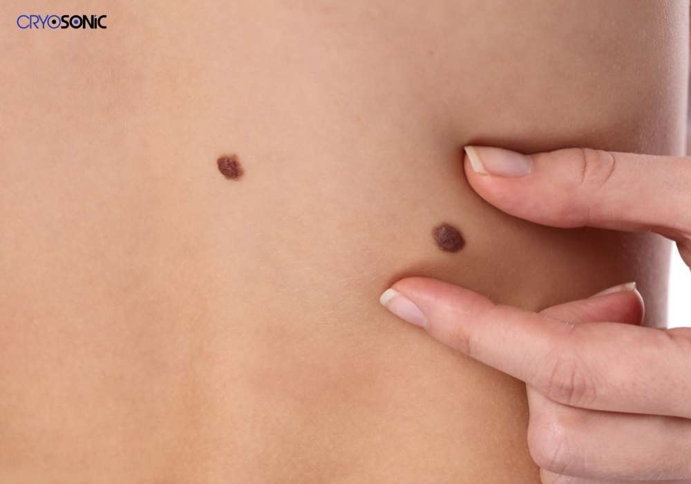 Infection Risk and Poor Aftercare Birkenhead