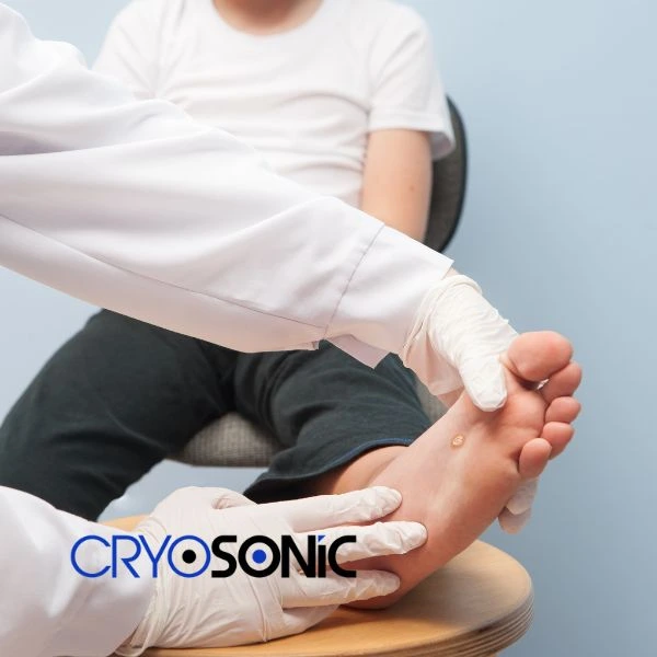 Are you looking for fast effective wart removal Contact us today Birkenhead