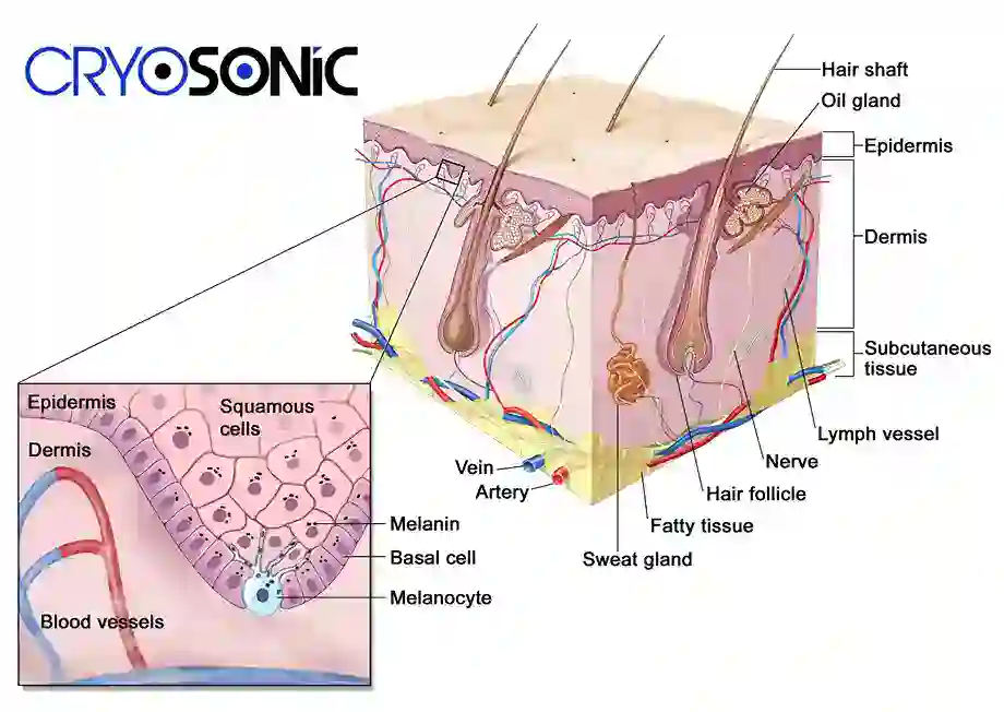 How Cryotherapy Stimulates Melanocyte Activity Birkenhead